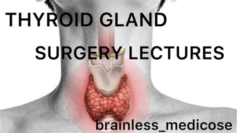 Thyroid Surgery Lecture Part 10 Hypothyroidism Mxoedema Coma