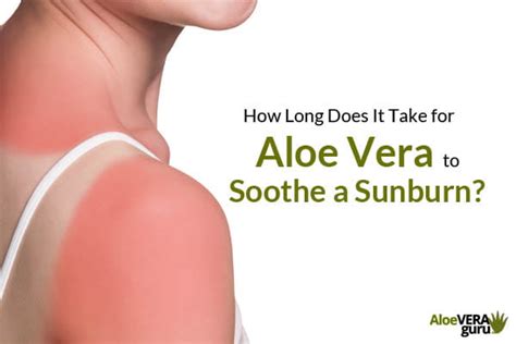 How Long Does It Take For Aloe Vera To Soothe A Sunburn