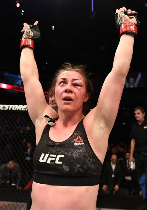 Ufcs Most Horrific Injuries After Joanna Jedrejczyck Is Left With
