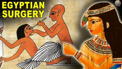 What Surgery Was Like In Ancient Egypt Youtube