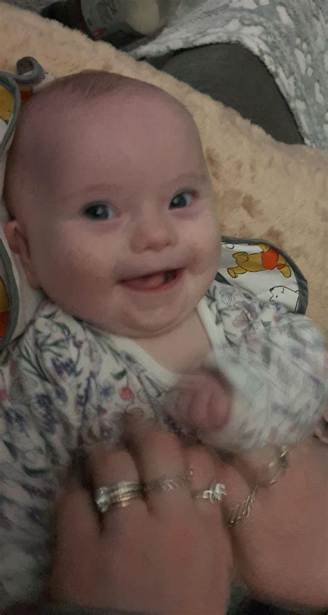 My 5 Month Old Daughter With Down Syndrome Is Really Discovering Her Smile Now Mademesmile