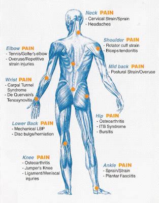 Understanding Arthritis Laminated Anatomical Chart Lupon Gov Ph