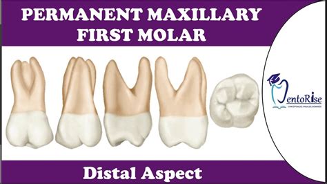 Permanent Maxillary First Molar Distal Aspect Tooth Morphology Dental Anatomy Molar
