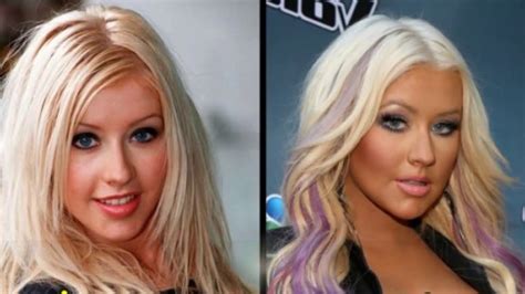 Famous Plastic Surgery Before And After
