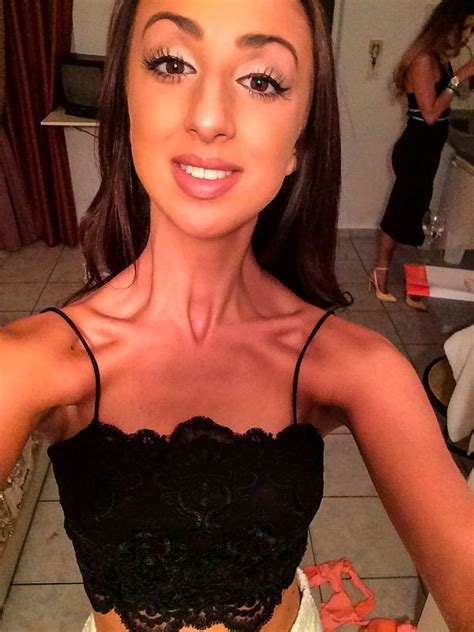 Teenage Bullying Victim Who Thought Being Skinny Made Her Attractive Battles Back From