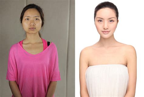 More Crazy Photos Of Chinese Plastic Surgery Amped Asia