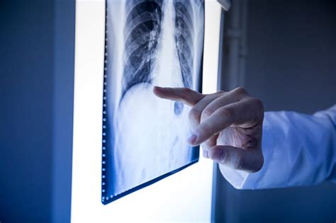 Doctor Looking X Ray Stock Photo Download Image Now Istock