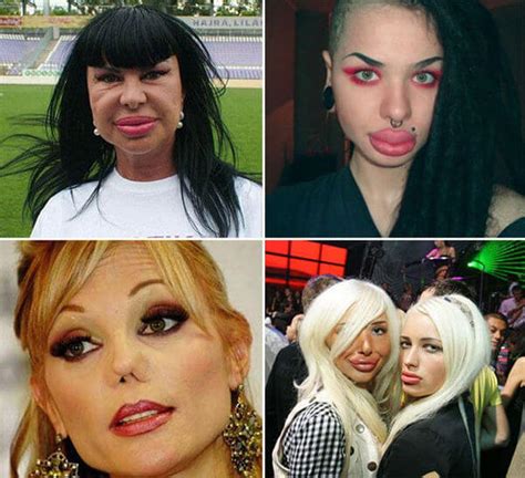 Plastic Surgery Gone Wrong Pictures That Will Make You Feel Uncomfortable But You Can T Look