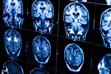 書名：困在大腦裡的人：揭開腦死、昏迷、植物人的意識世界，一位腦神經科學家探索生與死的邊界，原文名稱：into the gray zone：a neuroscientist explores the border between life and death，語言：繁體中文，isbn：9789578950290，頁數：432，出版社：采實文化，作者：安卓恩‧歐文，譯者：王念慈，出版日期：2018/04. 因腦死而摘取器官移植，是救人還是殺人？ - *CUP