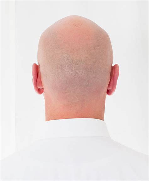 Best Bald Head Back Stock Photos Pictures And Royalty Free Images Istock