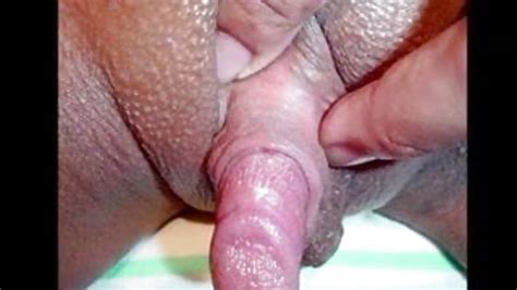 Worlds Biggest Clitoris Pictures Best Compilation Free Comments 2