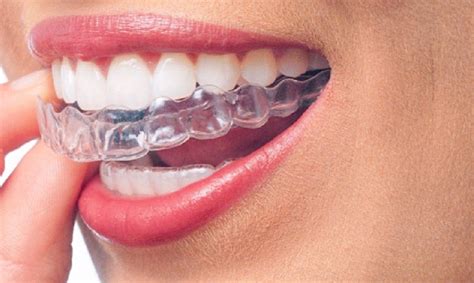 Invisalign Doctor Site Login How To Register And Login