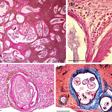 Histological Sections Of Cyst Nematodes In Gymnotus Inaequilabiatus