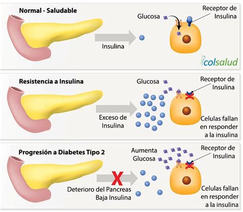 Resistencia A La Insulina Aprende Como Altera Tu Metabolismo Colsalud