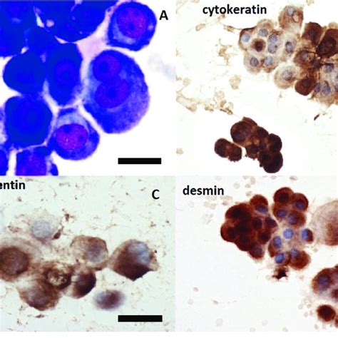 We did not find results for: (PDF) Using of immunocytochemistry in differential ...