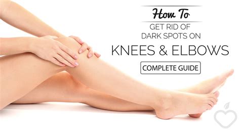 How To Get Rid Of Dark Knees And Elbows Fast Guide