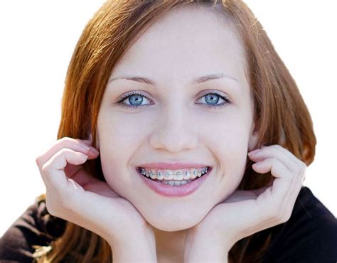 Teenage Orthodontics Why Your Kids Need To Have Braces Mom Does Reviews