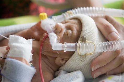 Premature Baby Feeding Challenges And Solutions Nicu Preemie Nicu Nurse