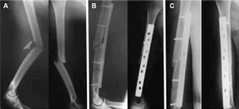 Radiographs On 39 Year Old Male Patient Who Was A Victim Of A
