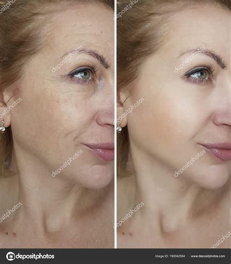 Face Woman Wrinkles Stock Photo By ©tanyalovus 190042504