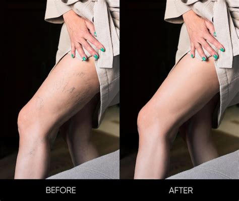 Premium Photo Comparison Of Two Photos Before And After Treatment