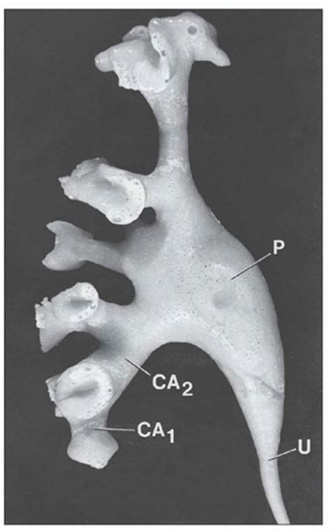 Renal Anatomy And Histology Abdominal Key