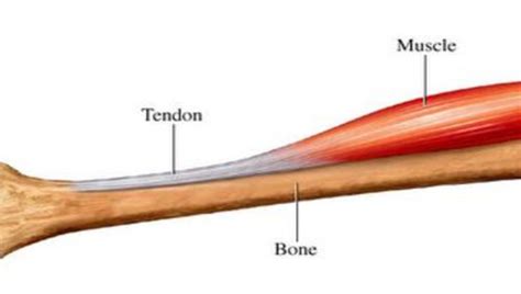Want to learn more about it? What is a tendon?