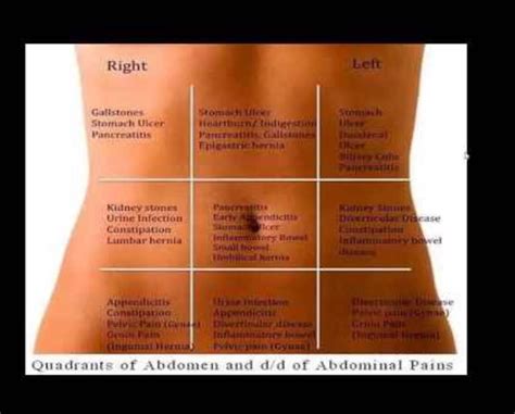 Top 5 Causes Of Severe Upper Abdominal Pain Abdominal Vrogue Co