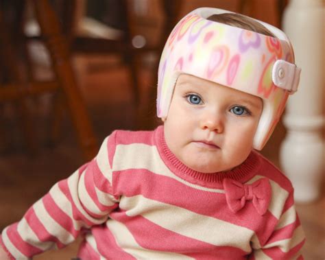 Plagiocephaly Helmets For Babies Flat Head Helmets Plagiocephaly