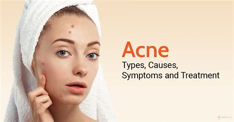 Acne Causes Symptoms Prevention And Treatment