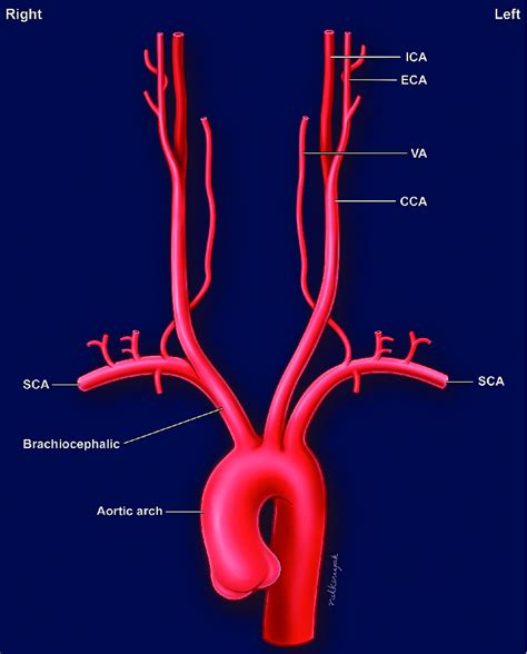 Aortic Arch Branches Arteries Arteries Anatomy Vertebral Artery