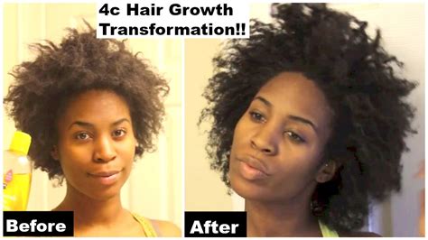 Forget hair greasing for moisturizing the hair. 4c hair growth transformation! 2015 - YouTube