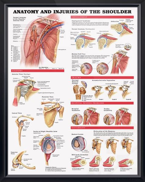 Shoulder pain doesn't have to be a fact of life. Anatomy and Injuries of the Shoulder anatomy poster ...