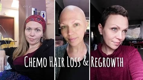 Chemo Hair Loss And Regrowth Timeline Youtube