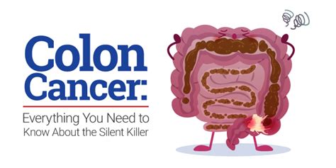 Colon Cancer: Everything You Need to Know About the Silent Killer | News | Makati Medical Center