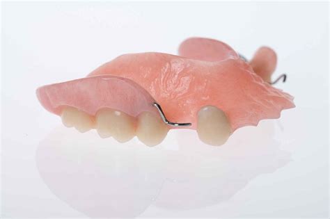 Acrylic Partial Dentures From 700 Cost And Prices Gold Coast