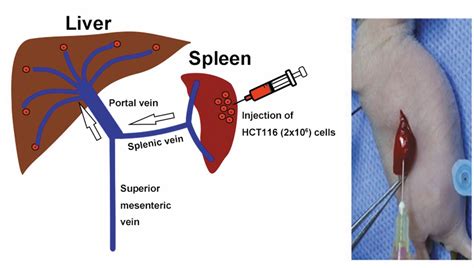 An Animal Model Of Colorectal Cancer Liver Metastasis With A High