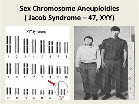 Chromosomal Disorder Numerical Aberrations Outline V Definition O