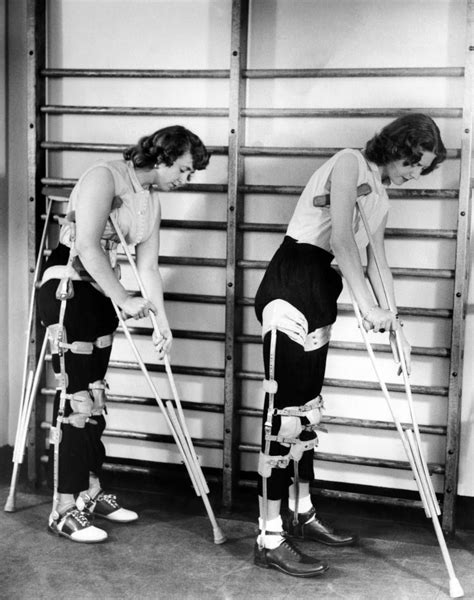 Two Adult Women Polio Victims With Leg Braces Adjust Their Crutches