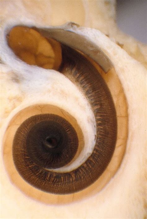 Pictures Of The Ear Deep In The Cochlea Cochlear Implant Anatomy