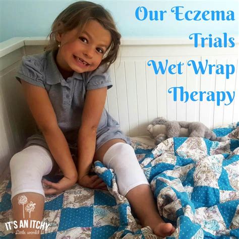 Our Eczema Trials Wet Wrap Therapy Eczema Treatment Severe Eczema