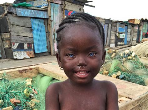 The African Eye An African Child With Rare Blue Eyes People With