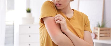 Alergia alimentar sintomas na pele Família e Casa