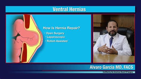 Robotic Ventral Hernia Repair Alvaro Garcia Md Youtube