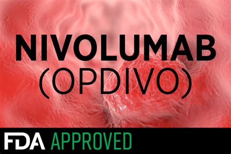 FDA OKs Nivolumab For Second Line Esophageal Cancer MedPage Today