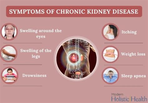 Chronic Kidney Disease A Warning Sign For Millions