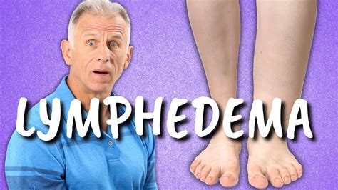 10 Exercises For Leg Lymphedema Swelling Or Edema Of The Lower