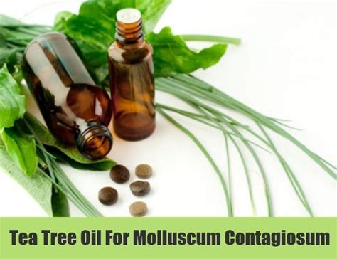 5 Best And Effective Ways To Cure Molluscum Contagiosum Naturally