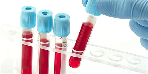 You sit or lie down to have the test. Breast Cancer Blood Tests Available -- But Not Proven ...