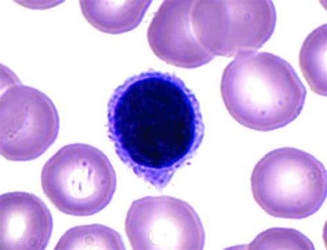 Solved What Type Of Leukocyte Wbc Do You See In This